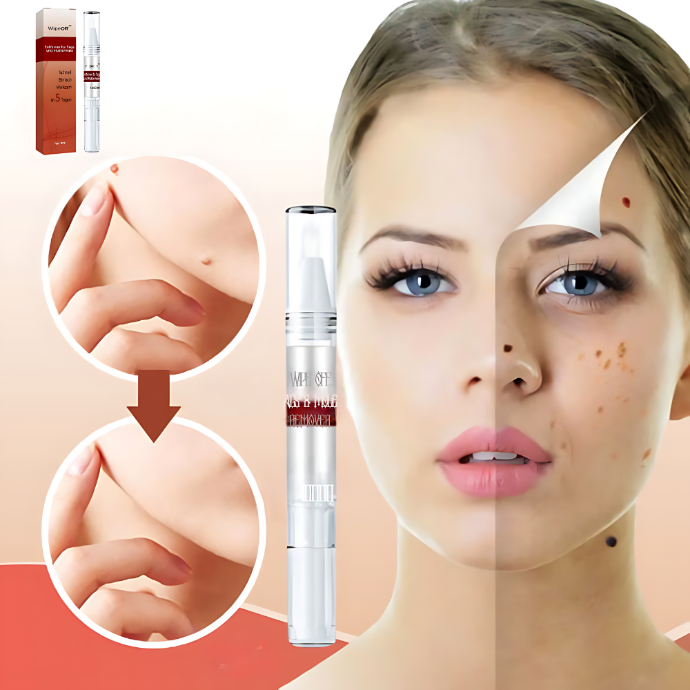 DermaPure Huidlabels Verwijderaar – Pijnloze & Veilige Oplossing voor Een Egale Huid 1