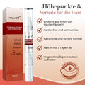 DermaPure Huidlabels Verwijderaar – Pijnloze & Veilige Oplossing voor Een Egale Huid 2