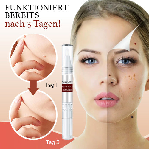 DermaPure Huidlabels Verwijderaar – Pijnloze & Veilige Oplossing voor Een Egale Huid 4