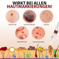 DermaPure Huidlabels Verwijderaar – Pijnloze & Veilige Oplossing voor Een Egale Huid 5