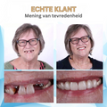 Moederdagcadeau | Bikenda | Ervaar het comfort van een kunstgebit voor een fractie van de prijs 5